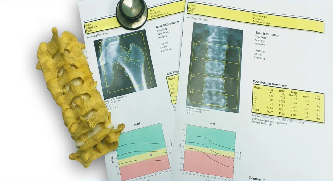 Title image for Bone Density And Masters Rowers