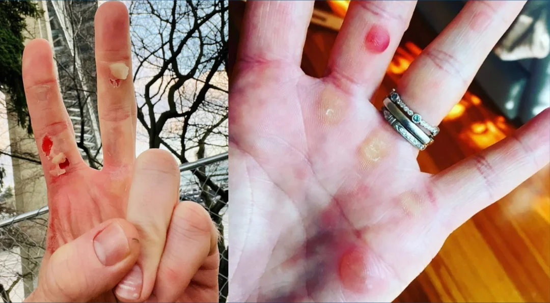 Title image for Rowing And Blisters: A Love Story