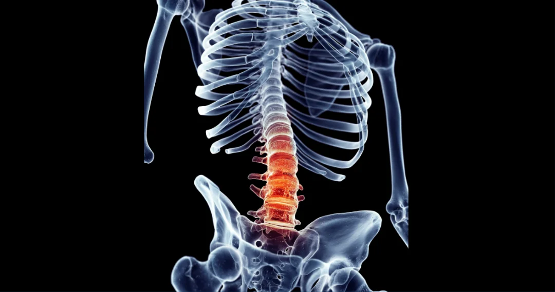 Title image for The Low Back Experience: Part II